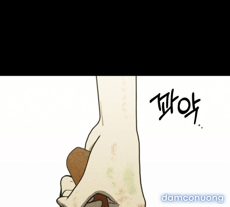 [15+] KHI TÔI BỊ CHÚ CHÓ TÔI BỎ RƠI CẮN 